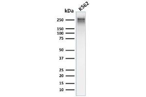 Western Blot Analysis of human K562 cell lysate using Spectrin alpha 1 Mouse Recombinant Monoclonal Antibody (rSPTA1/1832).