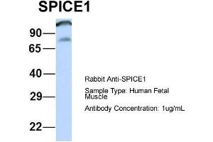 Host: Rabbit  Target Name: SPICE1  Sample Tissue: Human Fetal Muscle  Antibody Dilution: 1. (SPICE1 抗体  (Middle Region))