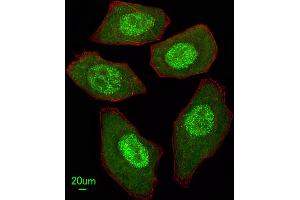 Immunofluorescent analysis of  cells, using FANCC Antibody (C-term) (ABIN653475 and ABIN2842896). (FANCC 抗体  (C-Term))