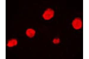 Immunofluorescent analysis of EZH1 staining in HeLa cells. (EZH1 抗体  (Center))