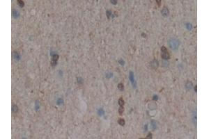 Immunohistochemistry (IHC) image for anti-Mitogen-Activated Protein Kinase 11 (MAPK11) (AA 38-277) antibody (ABIN7439378)