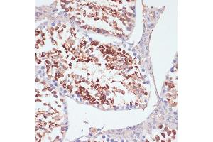 Immunohistochemistry of paraffin-embedded mouse testis using PKCδ antibody (ABIN6128464, ABIN6146203, ABIN6146204 and ABIN6213859) at dilution of 1:100 (40x lens). (PKC delta 抗体  (AA 477-676))