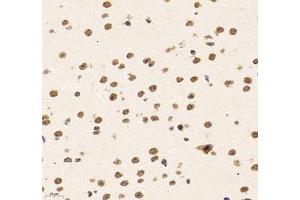 Immunohistochemistry of paraffin embedded mouse brain using SUPT3H (ABIN7075767) at dilution of 1: 1500 (400x lens) (SUPT3H/SPT3 抗体)