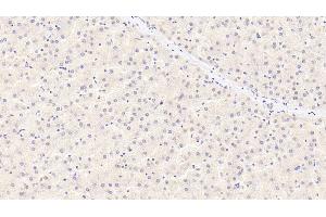 Detection of a2PI in Human Liver Tissue using Monoclonal Antibody to Alpha 2-Antiplasmin (a2PI) (alpha 2 Antiplasmin 抗体)