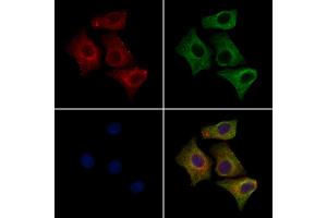 ABIN7094331 and ABIN7098378 staining HepG2 cells by IF/ICC.