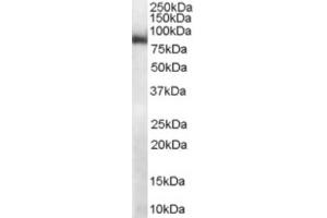 Western Blotting (WB) image for anti-Midline 2 (MID2) (C-Term) antibody (ABIN2465946) (Midline 2 抗体  (C-Term))