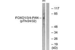 Western blot analysis of extracts from 293 cells treated with Serum 20% 15', using FOXO1/3/4-pan (Phospho-Thr24/32) Antibody. (FOXO1 抗体  (pThr24))