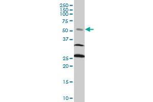 FOXC2 monoclonal antibody (M14), clone 4A3 Western Blot analysis of FOXC2 expression in PC-12 . (FOXC2 抗体  (AA 156-256))