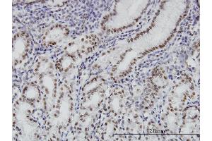Immunoperoxidase of monoclonal antibody to BRD3 on formalin-fixed paraffin-embedded human stomach. (BRD3 抗体  (AA 418-556))
