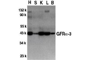 Western Blotting (WB) image for anti-GDNF Family Receptor alpha 3 (GFRA3) (Middle Region) antibody (ABIN1030939) (GFRA3 抗体  (Middle Region))