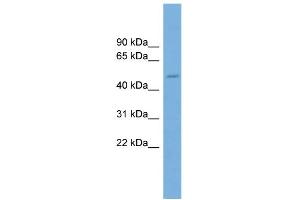 WB Suggested Anti-TRIM49 Antibody Titration: 0. (TRIM49 抗体  (Middle Region))