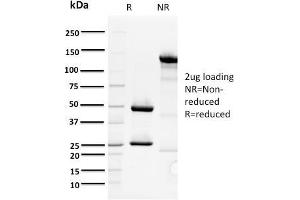 SDS-PAGE Analysis Purified ORC1 Mouse Monoclonal Antibody (7F6/1). (ORC1 抗体)