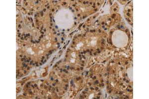 Immunohistochemistry (IHC) image for anti-Potassium Intermediate/small Conductance Calcium-Activated Channel, Subfamily N, Member 4 (KCNN4) antibody (ABIN2434884) (KCNN4 抗体)