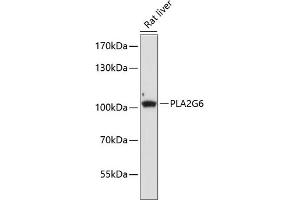 Western blot analysis of extracts of rat liver, using PLG6 antibody (ABIN6134886, ABIN6145732, ABIN6145733 and ABIN6225021) at 1:1000 dilution. (PLA2G6 抗体  (AA 550-650))