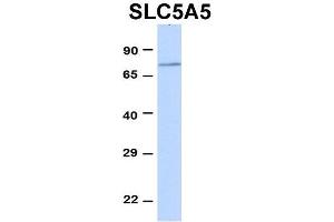 Host:  Rabbit  Target Name:  SLC5A5  Sample Type:  293T  Antibody Dilution:  1. (SLC5A5 抗体  (Middle Region))