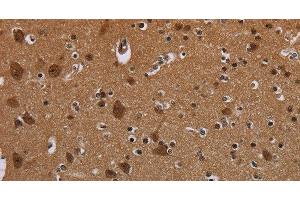 Immunohistochemistry of paraffin-embedded Mouse brain using MYCN Polyclonal Antibody at dilution 1:35 (MYCN 抗体)