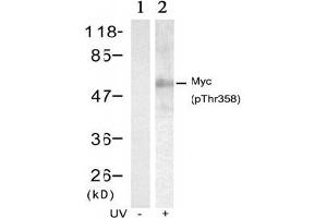 Image no. 2 for anti-Myc Proto-Oncogene protein (MYC) (pThr358) antibody (ABIN196675) (c-MYC 抗体  (pThr358))