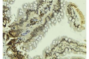Immunohistochemistry (IHC) image for anti-Sp1 Transcription Factor (SP1) (C-Term) antibody (ABIN6265245)