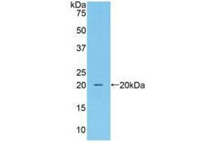 Western blot analysis of recombinant Mouse CAT. (Catalase 抗体  (AA 80-239))