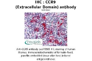 Image no. 1 for anti-Chemokine (C-C Motif) Receptor 9 (CCR9) (2nd Extracellular Domain) antibody (ABIN1732788) (CCR9 抗体  (2nd Extracellular Domain))