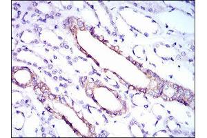 Immunohistochemistry (IHC) image for anti-Ribosomal Protein L18a (RPL18A) (AA 50-176) antibody (ABIN2983307) (RPL18A 抗体  (AA 50-176))