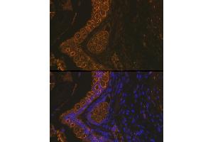 Immunofluorescence analysis of Rat rectum using Cytokeratin 18 (KRT18) antibody (ABIN7268097) at dilution of 1:100. (Cytokeratin 18 抗体)