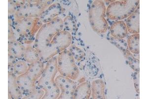DAB staining on IHC-P; Samples: Human Kidney Tissue (Plakophilin 1 抗体  (AA 500-742))
