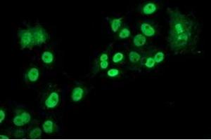Anti-LOX mouse monoclonal antibody (ABIN2453810) immunofluorescent staining of COS7 cells transiently transfected by pCMV6-ENTRY LOX (RC213323). (LOX 抗体  (AA 22-168))