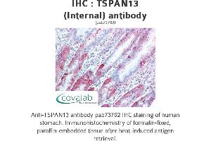 Image no. 2 for anti-Tetraspanin 13 (TSPAN13) (Internal Region) antibody (ABIN1740424) (TSPAN13 抗体  (Internal Region))