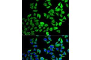 Immunofluorescence analysis of A-549 cells using USP8 Polyclonal Antibody (USP8 抗体)