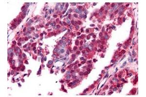 Immunohistochemistry (IHC) image for anti-Early Growth Response 1 (EGR1) (AA 85-115) antibody (ABIN129622)
