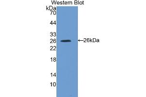Western Blotting (WB) image for anti-Suppressor of Cytokine Signaling 3 (SOCS3) (AA 1-225) antibody (ABIN1078553) (SOCS3 抗体  (AA 1-225))