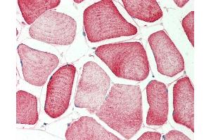 Immunohistochemistry (IHC) image for anti-Protein tyrosine Phosphatase, Receptor Type, R (PTPRR) (AA 282-331) antibody (ABIN6755436)
