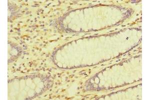 Immunohistochemistry (IHC) image for anti-Zinc Finger, DHHC-Type Containing 23 (ZDHHC23) (AA 187-302) antibody (ABIN7162546)