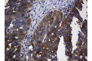 Image no. 1 for anti-TSC22 Domain Family, Member 1 (TSC22D1) antibody (ABIN1501537) (TSC22D1 抗体)