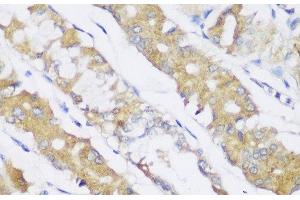 Immunohistochemistry of paraffin-embedded Human stomach using FA2H Polyclonal Antibody at dilution of 1:150 (40x lens). (FA2H 抗体)