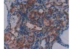 Immunohistochemistry (IHC) image for anti-N-Methylpurine-DNA Glycosylase (MPG) (AA 221-296) antibody (ABIN7436513)