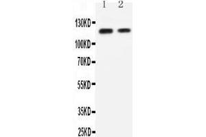 Anti-P cadherin antibody, Western blotting Lane 1: Recombinant Human P-Cadherin Protein 10ng Lane 2: Recombinant Human P-Cadherin Protein 5ng (P-Cadherin 抗体  (Middle Region))