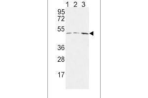 HLN1 Antibody (N-term) 9791a western blot analysis in MCF-7(lane 1),Jurkat(lane 2),HepG2(lane 3) cell line lysates (35 μg/lane). (HAPLN1 抗体  (N-Term))