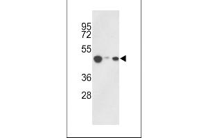 Western blot analysis of hHAT1-E404 in 293, HepG2, Jurkat cell line lysates (35ug/lane) (HAT1 抗体  (C-Term))