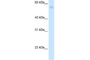 Western Blotting (WB) image for anti-Solute Carrier Family 2 (Facilitated Glucose Transporter), Member 2 (SLC2A2) (N-Term) antibody (ABIN2776949)