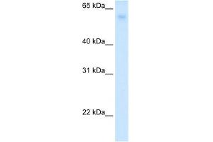 WB Suggested Anti-SLC2A2 Antibody Titration:  0. (SLC2A2 抗体  (N-Term))