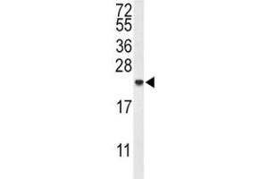 Western Blotting (WB) image for anti-Interleukin 10 (IL10) (AA 27-53) antibody (ABIN3031441)