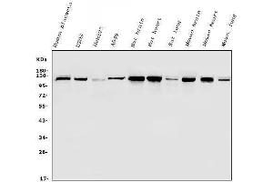 Western blot analysis of Hexokinase 1/HK1 using anti-Hexokinase 1/HK1 antibody (ABIN7600260).