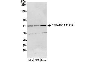 Western Blotting (WB) image for anti-Centrosomal Protein 44kDa (CEP44) (AA 340-390) antibody (ABIN7450980)