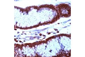 Immunohistochemistry (IHC) image for anti-Baculoviral IAP Repeat-Containing 5 (BIRC5) (N-Term) antibody (ABIN4369171) (Survivin 抗体  (N-Term))