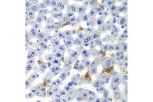Immunohistochemistry of paraffin-embedded rat liver using NR0B2 antibody (ABIN5970937) at dilution of 1/100 (40x lens). (NR0B2 抗体)