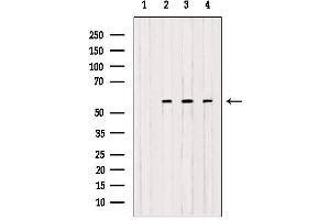 Western blot analysis of extracts from various samples, using OXCT1 antibody. (OXCT1 抗体  (Internal Region))