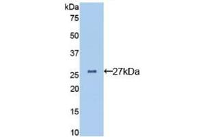 Western blot analysis of recombinant Mouse CLU. (Clusterin 抗体  (AA 227-447))