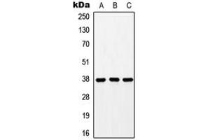 Western blot analysis of GPR171 expression in HEK293T (A), mouse liver (B), rat liver (C) whole cell lysates. (GPR171 抗体  (Center))